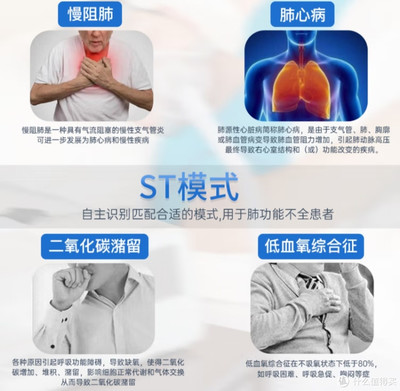 家用呼吸机推荐 为何ST模式呼吸机被誉为“超级好用”的睡眠健康守护者