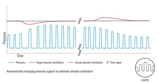 家用慢阻肺呼吸机ST、AVAPS与iVApS模式详解与区别
